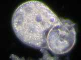 Plagiocampa & Vorticella